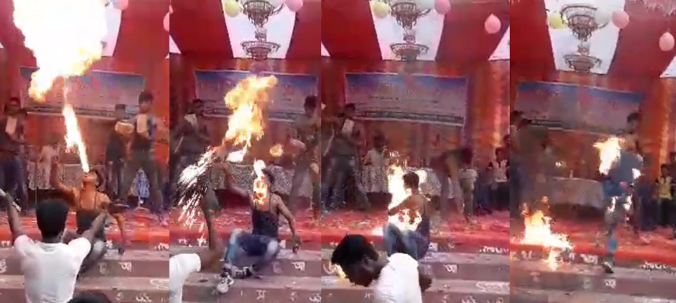 আগুন খেলা দেখাতে গিয়ে স্কুলছাত্র অগ্নিদগ্ধ