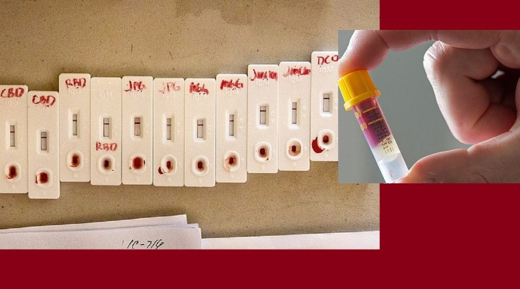 করোনাভাইরাস আক্রান্তদের মাত্র ১০ শতাংশের শরীরে অ্যান্টিবডি তৈরি হয়েছে!