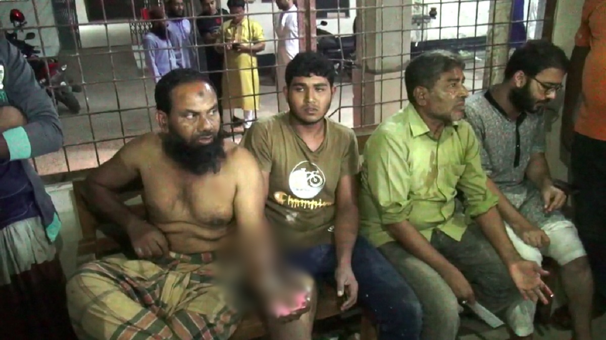 ঝিনাইদহে পাগলা কুকুরের কামড়ে ১৯ জন হাসপাতালে