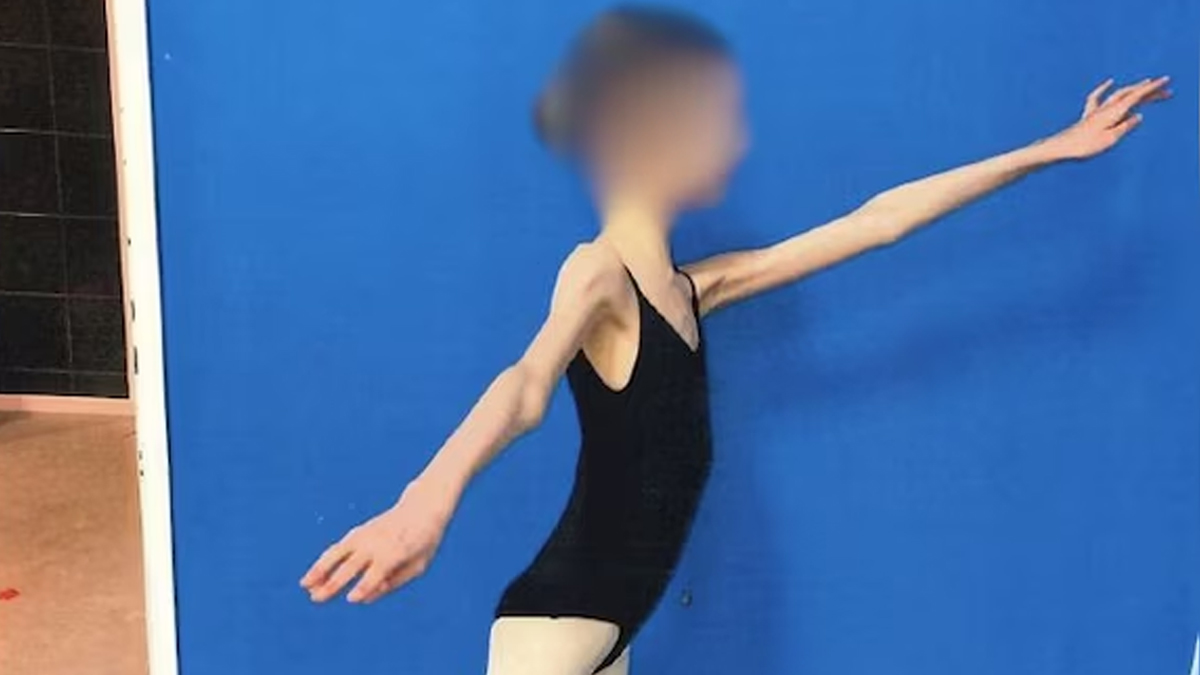 অস্ট্রেলিয়ায় মেয়েকে চিরকাল ‘বাচ্চা’ রাখতে অনাহারে রাখে বাবা-মা