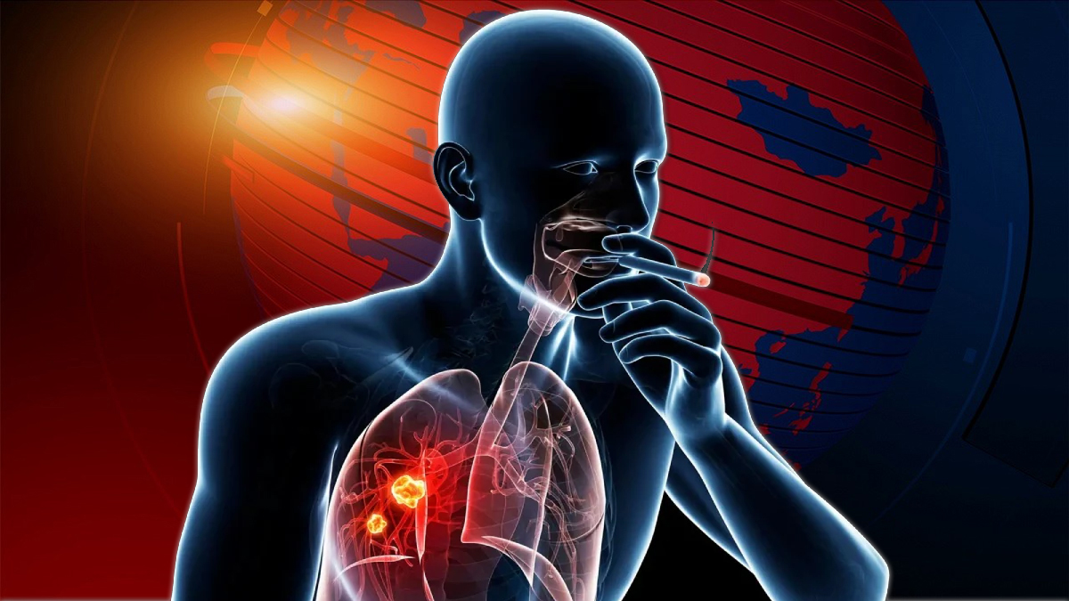 তামাকজনিত রোগে বছরে এক লাখ ৬২ হাজার মৃত্যু