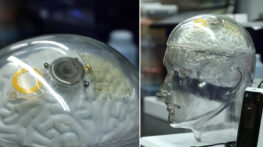 মস্তিষ্ক প্রযুক্তিতে যুক্তরাষ্ট্রকে টক্কর দিচ্ছে চীন, মাস্কের নিউরালিঙ্কের প্রতিদ্বন্দ্বী হয়ে উঠছে বেইনাও-১